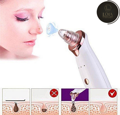 SuctionGlow © - Aparelho Removedor de Cravos a Vácuo Extração por Sucção